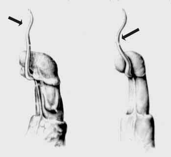 Hlth Cond: RumUro_Fig2